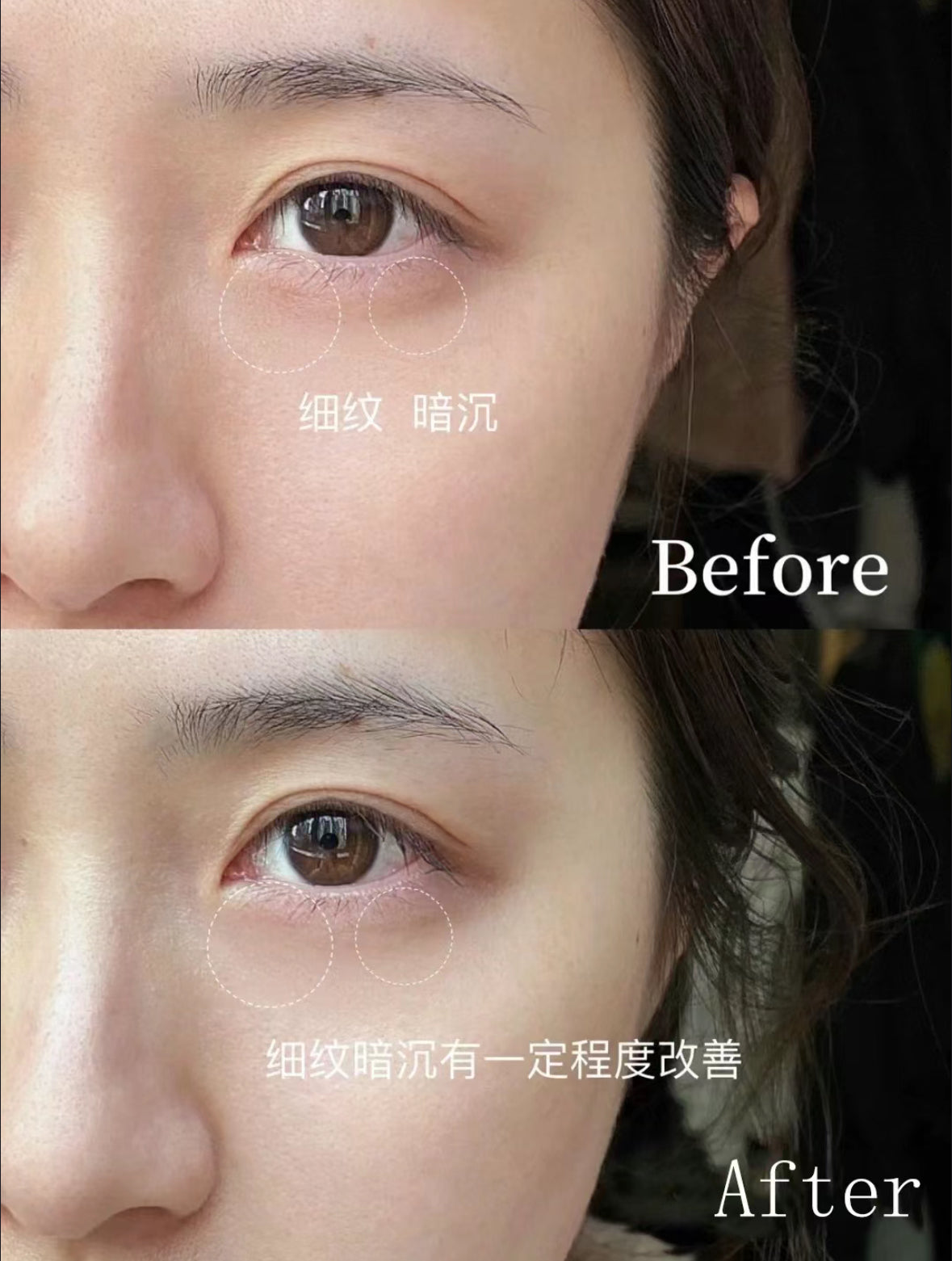 Estée Lauder | 升級再生基因修復眼霜15ml