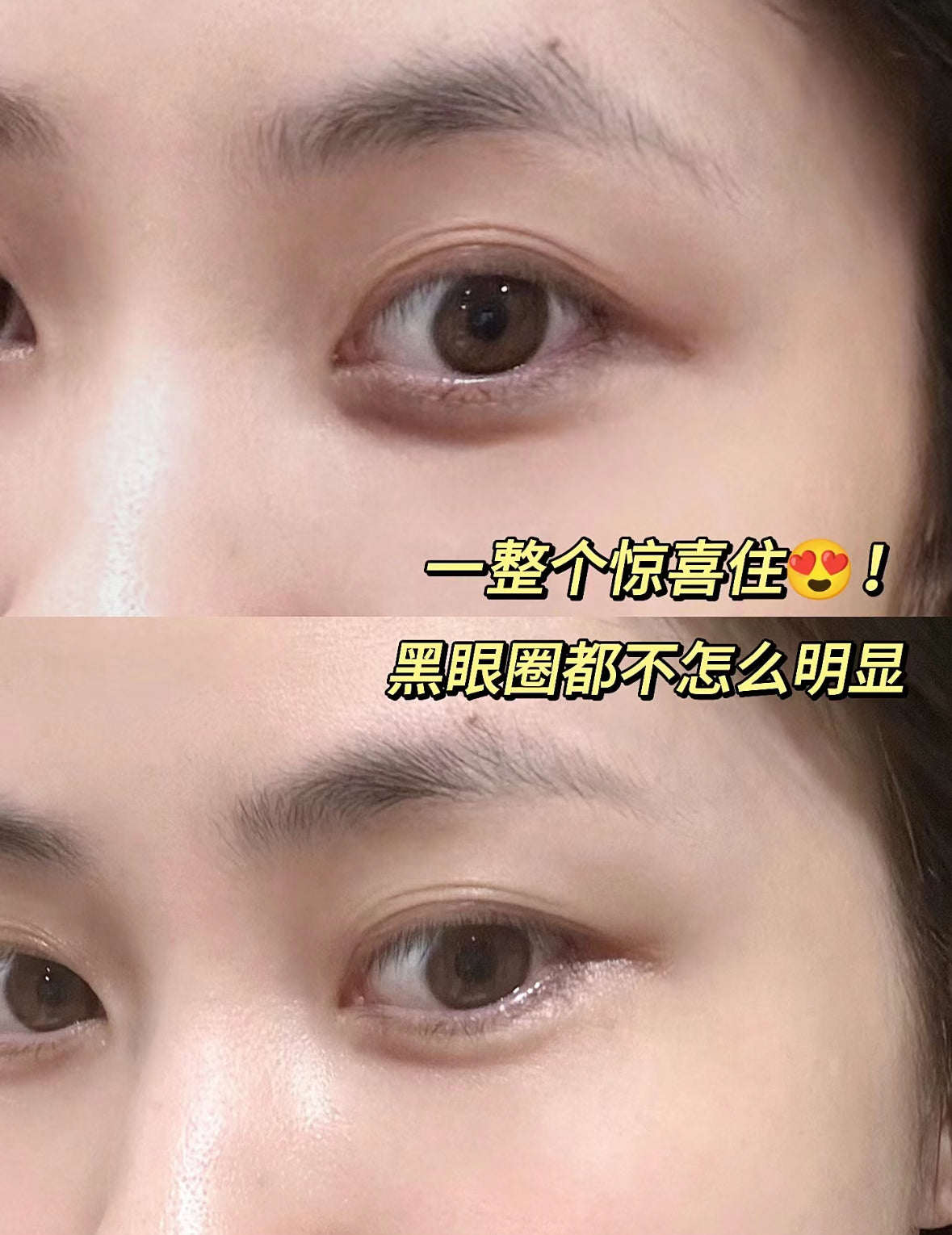 Lancome | 小黑瓶眼霜15ml