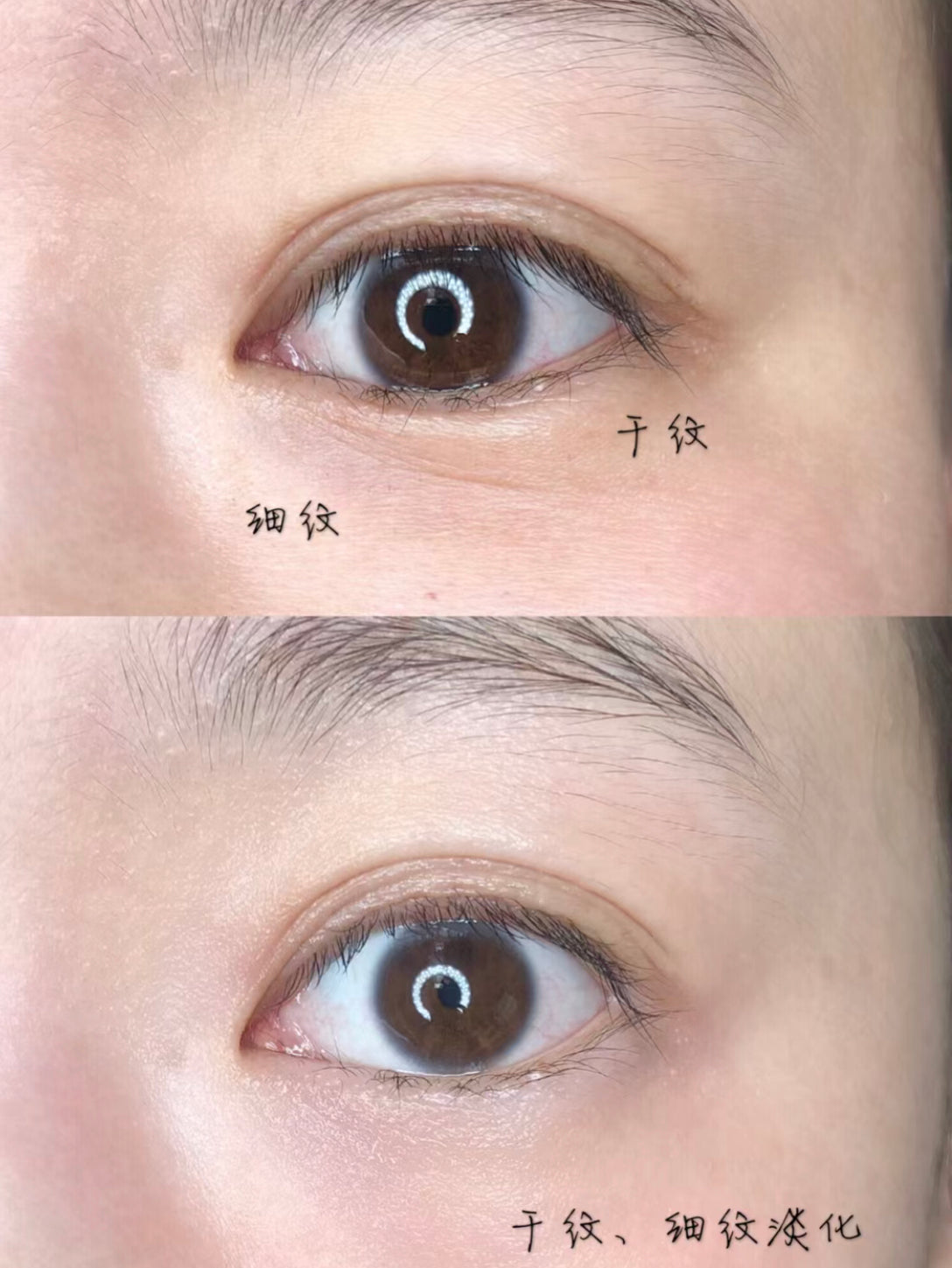 Fresh |Black Tea Eye Concentrate | 紅茶緊致眼霜|15ML