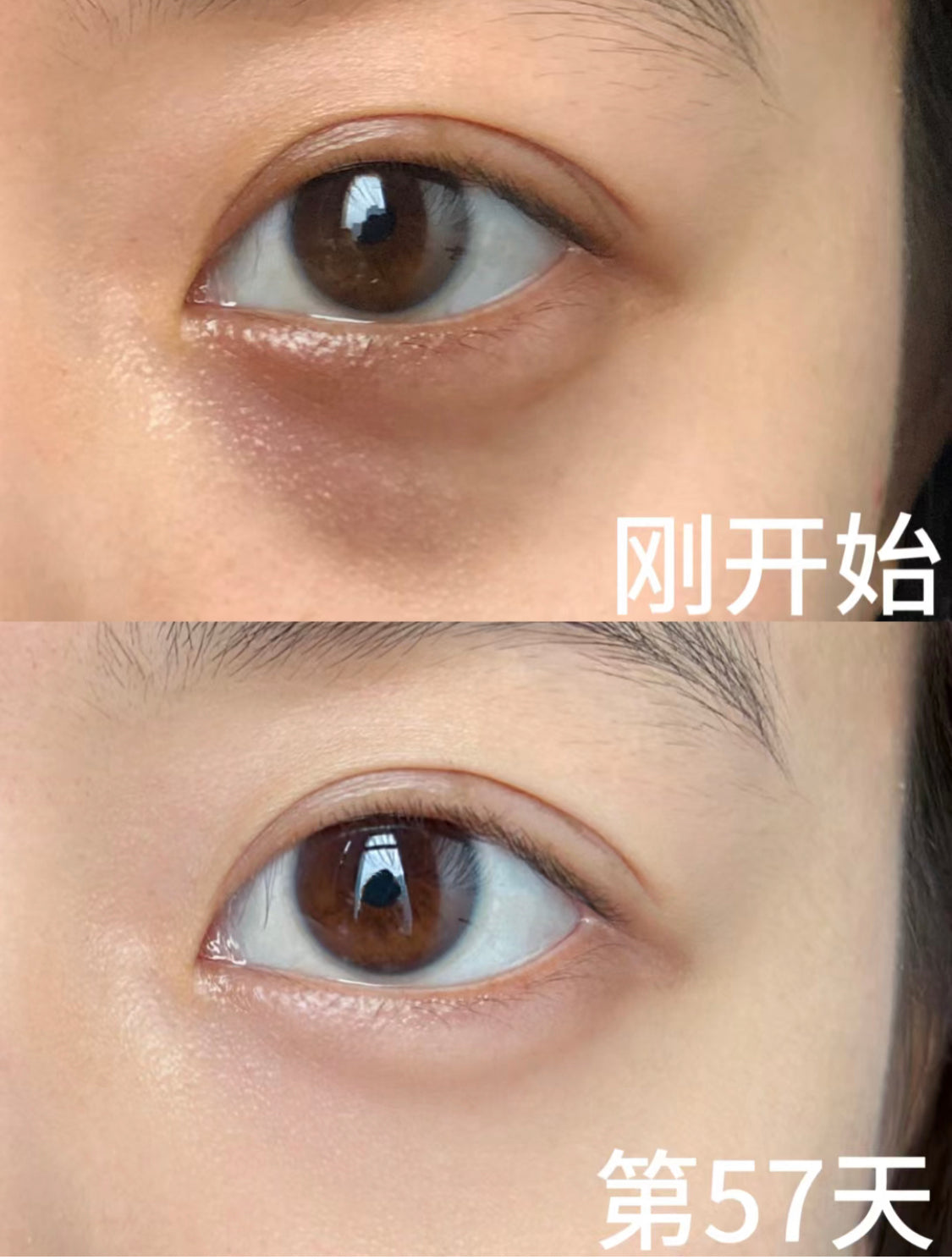 Clinique|All About Eyes |眼部護理水凝霜|無盒